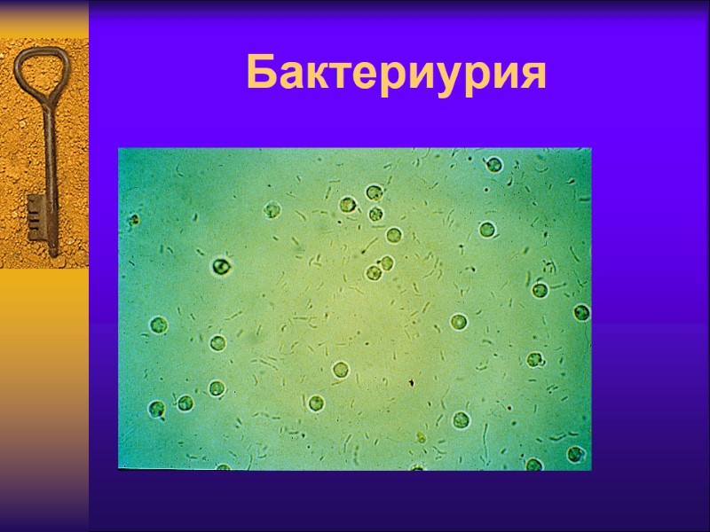 Бактериурия